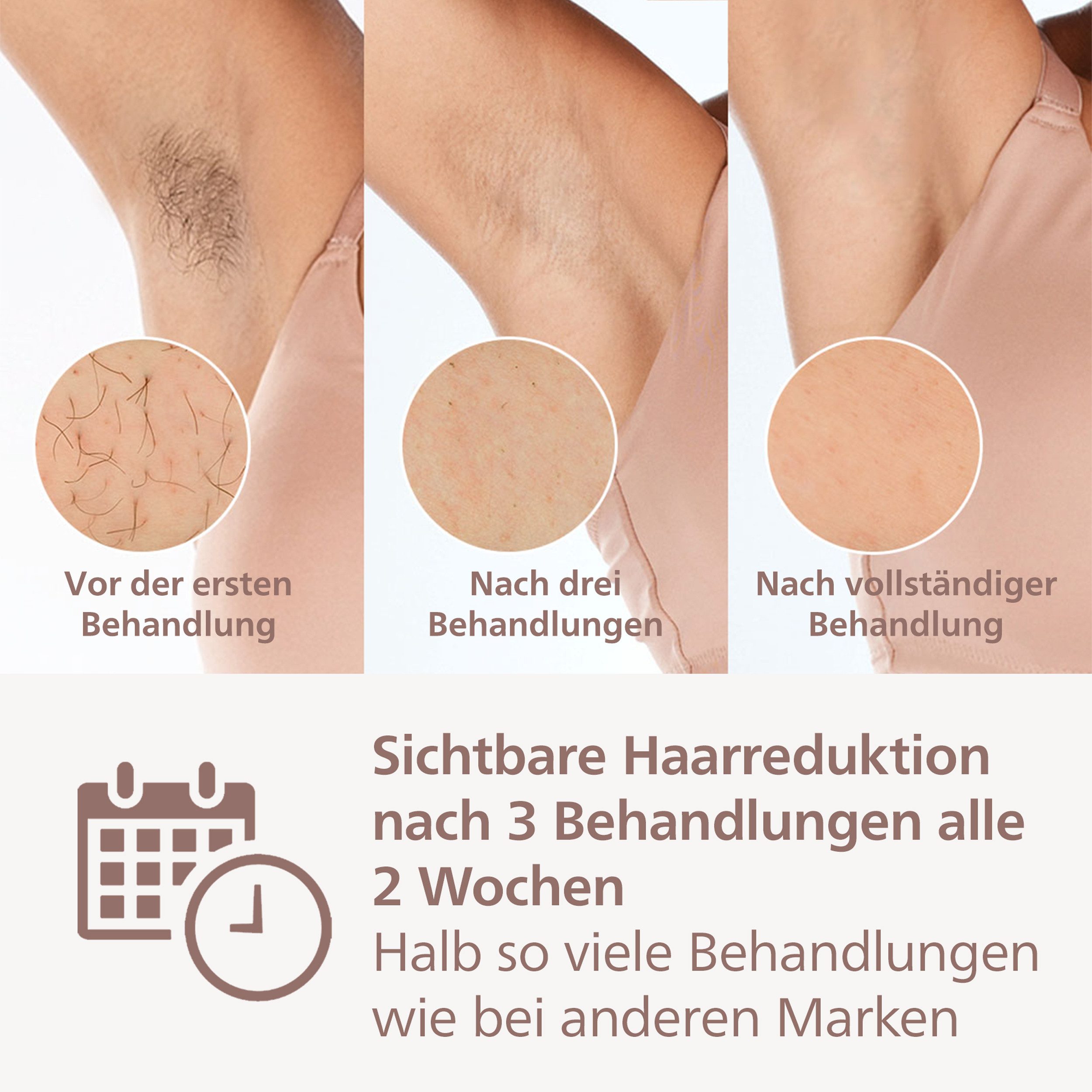 Philips IPL-ontharingsapparaat Lumea S9000 BRI958/00 4 opzetstukken (oksels, bikinilijn, lichaam en gezicht), draadloos