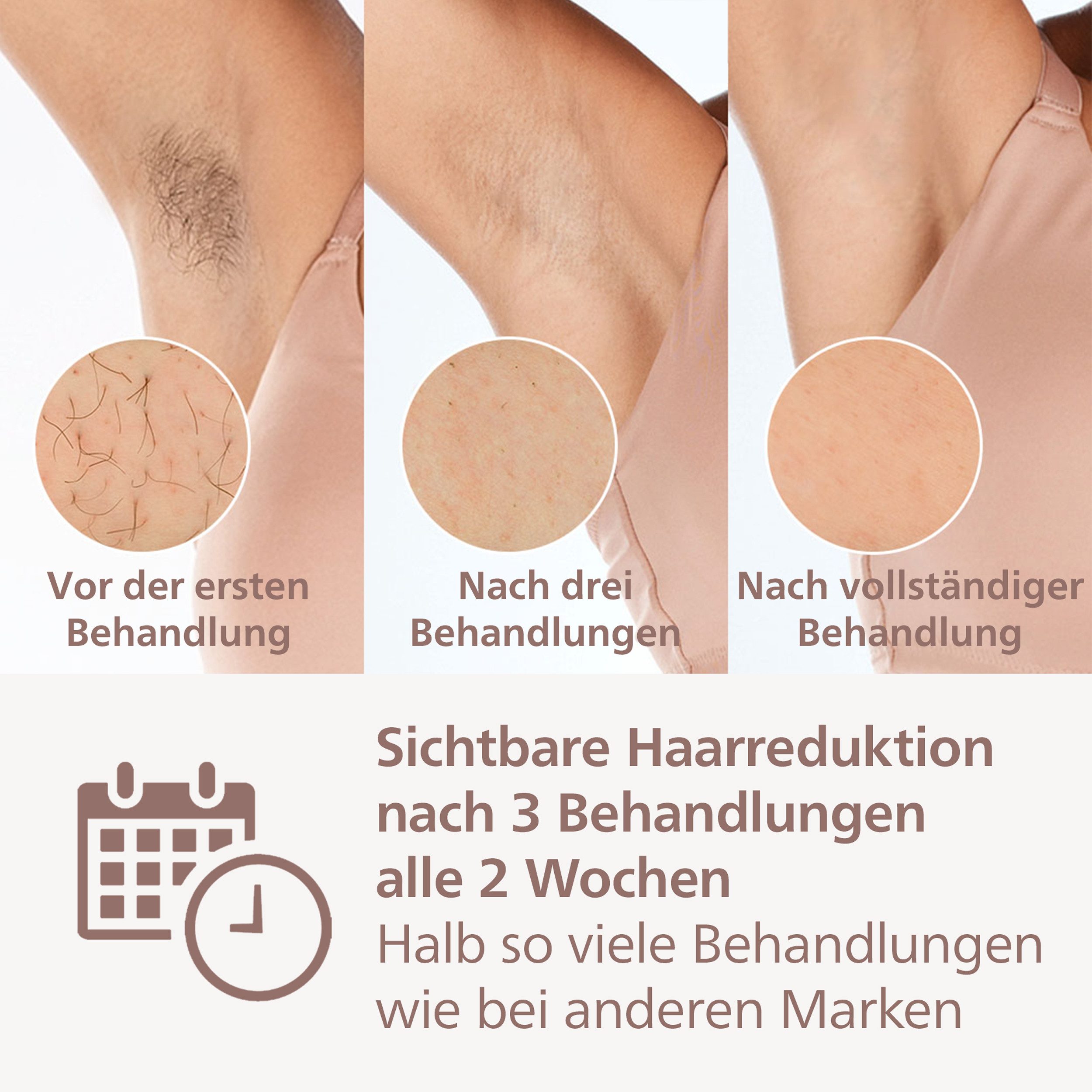 Philips IPL-ontharingsapparaat Lumea S8000 BRI947/00 4 opzetstukken (oksels, bikinilijn, lichaam en gezicht)