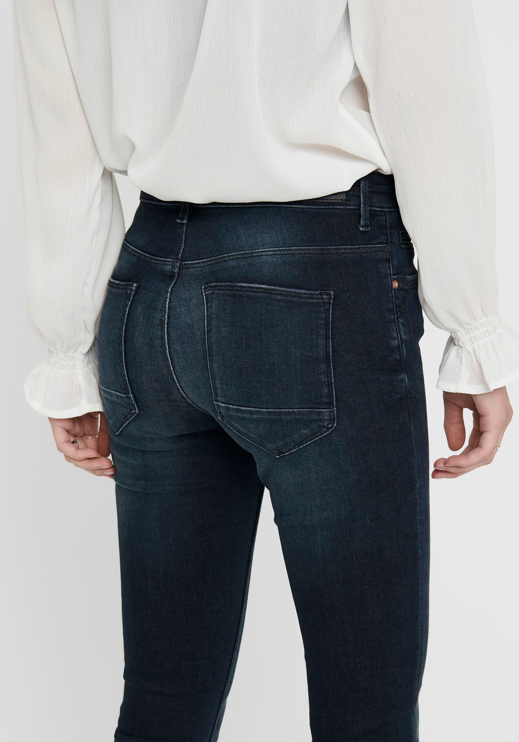 Only Skinny fit jeans ONLKENDELL LIFE REG SK ANKLE