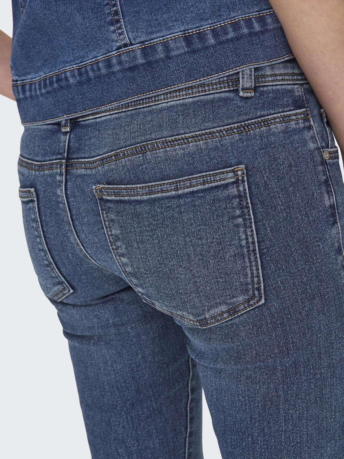 Only Skinny fit jeans ONLANEMONE MID SK VIS BUT DES DNM PIM