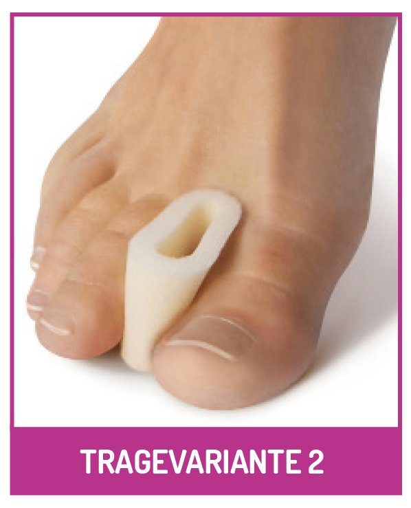 Fußgut Tenenspreider Hallux valgus teenspreiderset "Variant" (set)