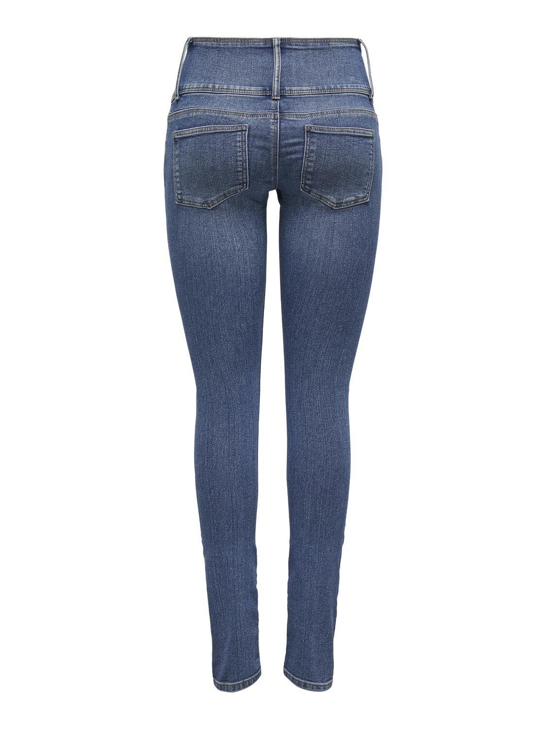 Only Skinny fit jeans ONLANEMONE MID SK VIS BUT DES DNM PIM