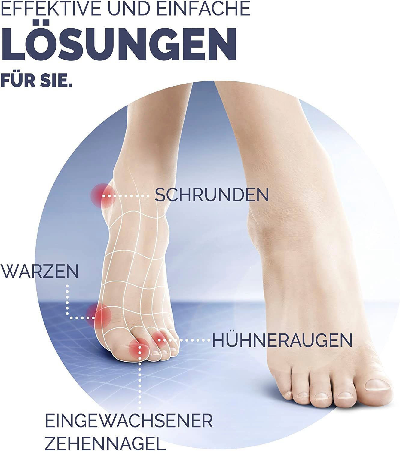 Scholl Wrattenbehandelingspen Freeze Wrattenverwijderaar sticks voor handen en voeten (16-delig)