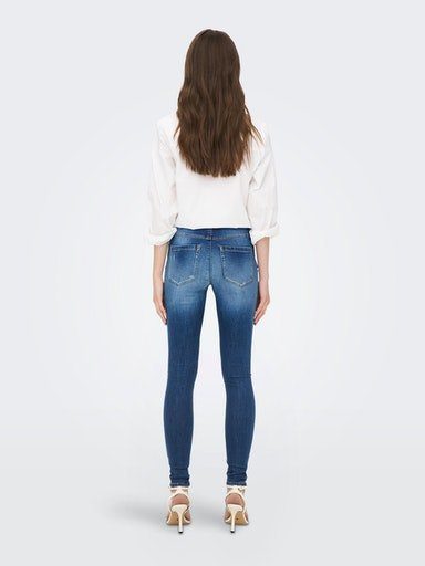 only skinny fit jeans onlroyal hw skinny dnm genbox blauw