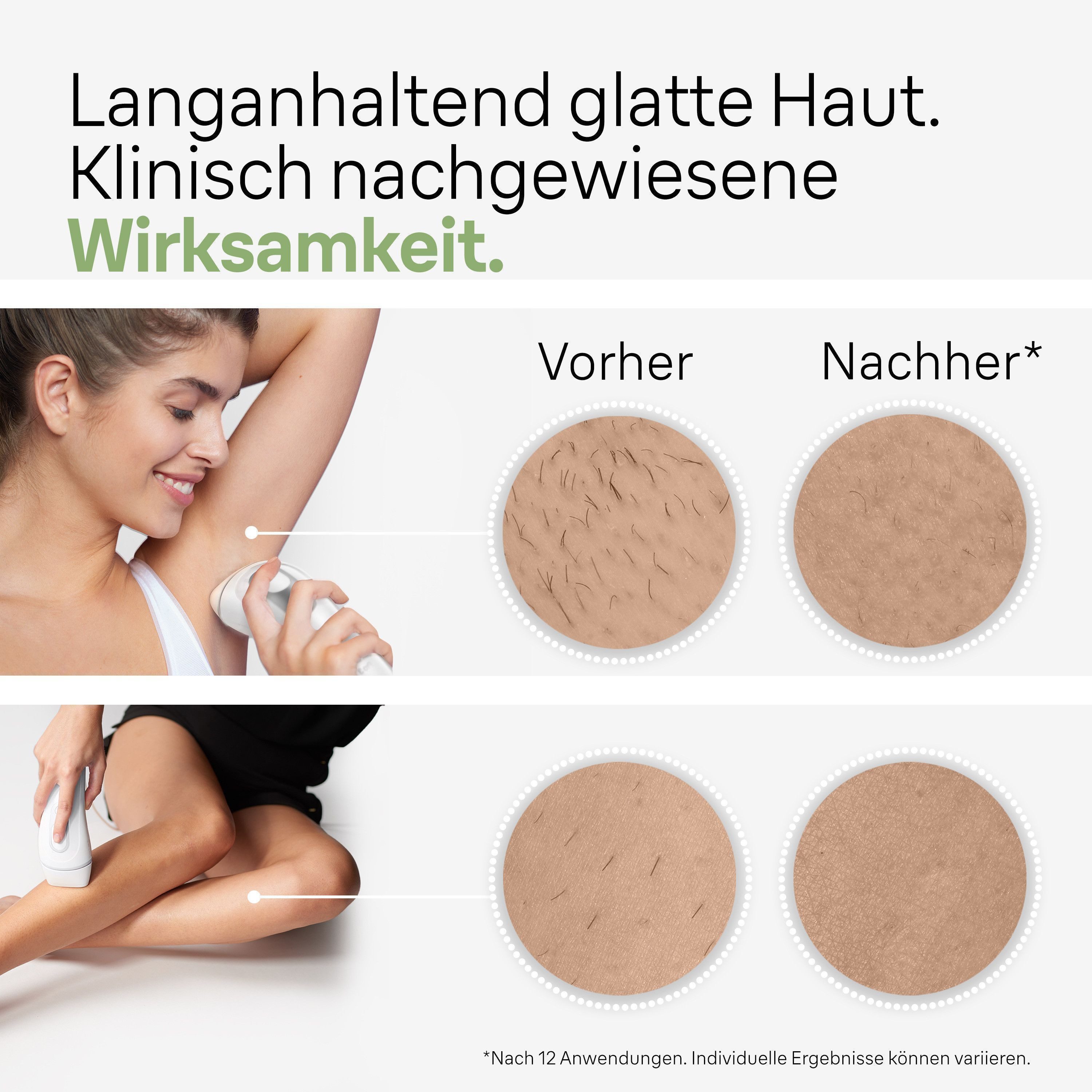 Braun IPL-ontharingsapparaat Silk·expert Pro 3 PL3136 2 opzetstukken, venus scheermes, met opbergtas