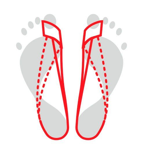 Fußgut Hallux-band Correctielus, in alle schoenen te dragen, vlakke afwerking Trekkoord ergonomisch gevormd, trekband elastisch, flexibel