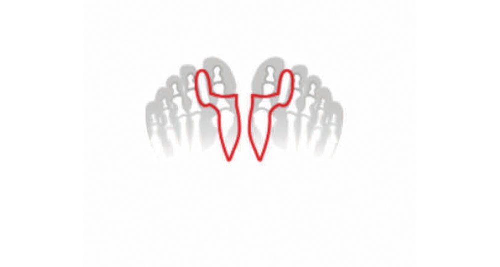 Fußgut Tenencorrector Hallux corrector met balenbescherming, aangenaam zacht van softgel (set, 2-delig)